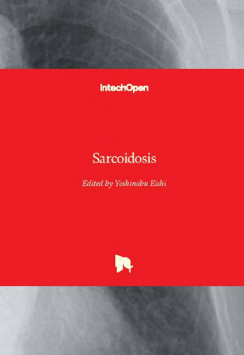Sarcoidosis / edited by Yoshinobu Eishi