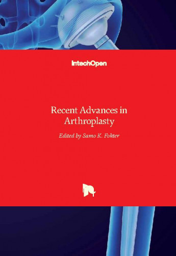 Recent advances in arthroplasty / edited by Samo K. Fokter