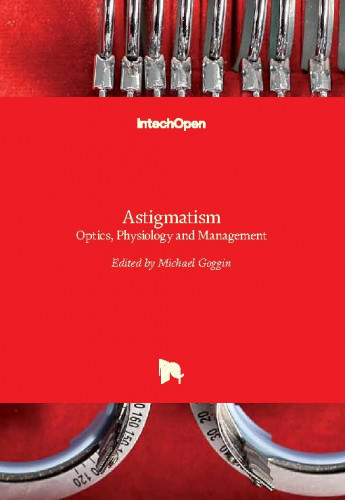 Astigmatism - optics, physiology and management edited by Michael Goggin