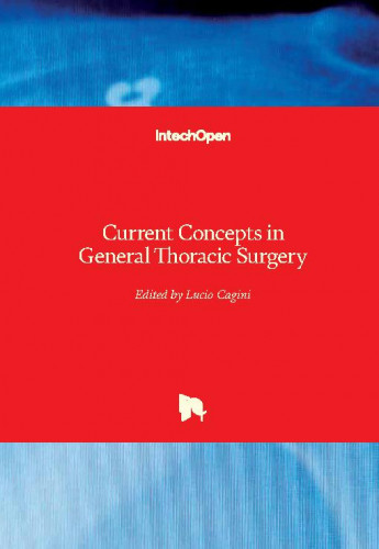 Current concepts in general thoracic surgery / edited by Lucio Cagini