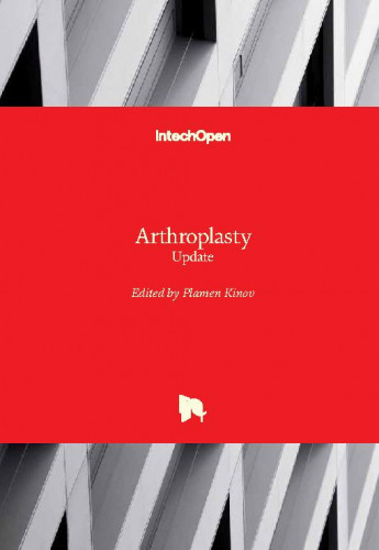 Arthroplasty : update / edited by Plamen Kinov