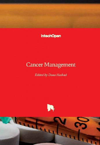 Cancer management / edited by Doaa Hashad