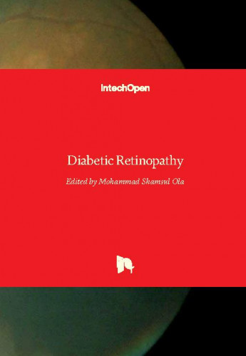 Diabetic retinopathy edited by Mohammad Shamsul Ola