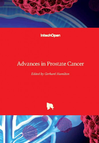 Advances in prostate cancer / edited by Gerhard Hamilton