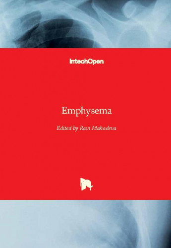 Emphysema / edited by Ravi Mahadeva