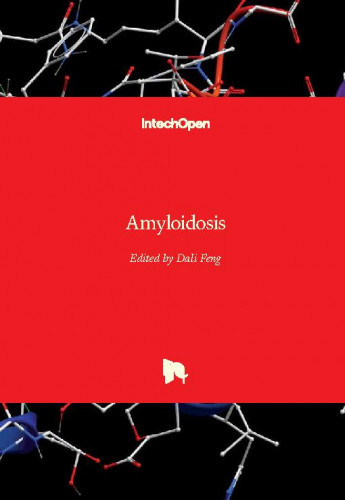 Amyloidosis / edited by Dali Feng
