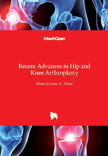 Recent advances in hip and knee arthroplasty / edited by Samo K. Fokter